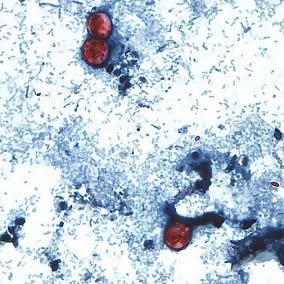 Michigan Cyclospora Outbreak: What It Means for Bonz Beach Farms Fresh Produce
